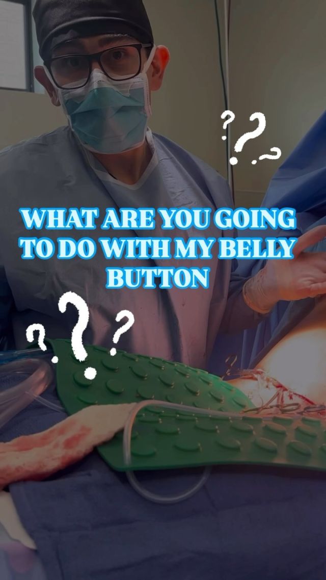 Have you ever thought… What about my belly button? What happens to my belly button? Will I get a new belly button? 

We know what you’re thinking when it comes to tummy tucks. The most asked question, “Will I get a new belly button?” 

The answer is simple, Dr.Masters use your very own Belly button. 

Watch how.. ▶️

#mommymakeover #extendedtummytuck #tummytuck #liposuction #lipo #bodylift360 #safelipo #nicholshills #plasticsurgeon #plastics #boardcertified #newyou #plasticsurgeonsofinstagram #mastersplasticsurgery #drOKC