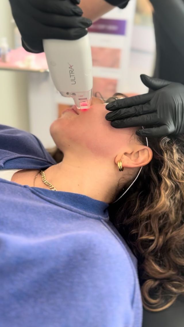 BRIDES💍 

Is it time to start prep for your big day? 

Our Ultra laser is an all-in-one laser treatment that not only smooths and resurfaces your skin but also helps reveal a radiant, even complexion. This is great for brides, prepping for that beautiful glowing skin.  The ultimate bridal glow🤍

#ultrabridalglow #ultra #texturerepair #weddingprep #radiantskin #cynosure #Lutronic #nicholshills #wilsherblvd #plastics #plasticsurgeons #mastersplasticsurgery #drOKC